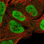 Immunofluorescent staining of human cell line U-2 OS shows localization to nucleoplasm & vesicles.