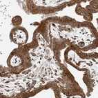 Immunohistochemical staining of human placenta shows strong cytoplasmic positivity in trophoblastic cells.