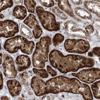 Immunohistochemical staining of human kidney shows strong granular cytoplasmic positivity in cells in tubules.