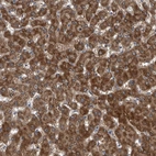 Immunohistochemical staining of human liver shows moderate granular cytoplasmic positivity in hepatocytes.