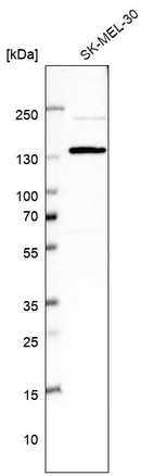 Western blot analysis in human cell line SK-MEL-30.