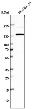 Western blot analysis in human cell line SK-MEL-30.