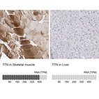 Anti-TTN Antibody