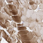 Immunohistochemical staining of human skeletal muscle shows high expression.