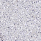 Immunohistochemical staining of human liver shows low expression as expected.