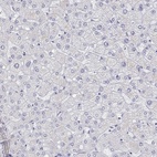 Anti-TTN Antibody