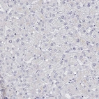 Immunohistochemical staining of human liver shows low expression as expected.