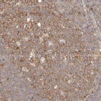 Anti-EPRS Antibody