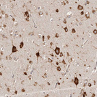Immunohistochemical staining of human cerebral cortex shows strong cytoplasmic positivity in neurons.