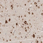 Immunohistochemical staining of human cerebral cortex shows strong cytoplasmic positivity in neurons.