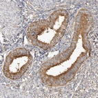 Immunohistochemical staining of human endometrium shows moderate cytoplasmic positivity in glandular cells.