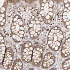 Immunohistochemical staining of human rectum shows moderate cytoplasmic positivity in glandular cells.