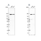 Western blot analysis using Anti-EPRS antibody HPA030052 (A) shows similar pattern to independent antibody HPA026490 (B).