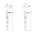 Western blot analysis using Anti-EPRS antibody HPA030052 (A) shows similar pattern to independent antibody HPA026490 (B).