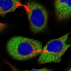 Immunofluorescent staining of human cell line U-2 OS shows localization to cytosol.