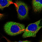 Immunofluorescent staining of human cell line U-2 OS shows localization to cytosol.