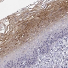 Immunohistochemical staining of human esophagus shows strong granular cytoplasmic positivity in squamous epithelial cells.
