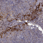 Immunohistochemical staining of human tonsil shows strong granular cytoplasmic positivity in squamous epithelial cells.