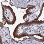 Immunohistochemical staining of human placenta shows strong granular cytoplasmic positivity in trophoblastic cells.