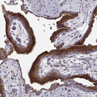 Anti-ERO1A Antibody