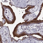 Immunohistochemical staining of human placenta shows strong granular cytoplasmic positivity in trophoblastic cells.