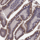 Immunohistochemical staining of human small intestine shows moderate granular cytoplasmic positivity in glandular cells.
