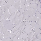 Immunohistochemical staining of human skeletal muscle shows no positivity in myocytes as expected.
