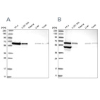 Western blot analysis using Anti-ERO1A antibody HPA030053 (A) shows similar pattern to independent antibody HPA026653 (B).