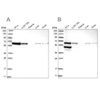 Western blot analysis using Anti-ERO1A antibody HPA030053 (A) shows similar pattern to independent antibody HPA026653 (B).