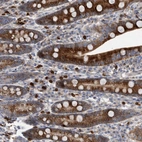 Anti-CRISPLD2 Antibody