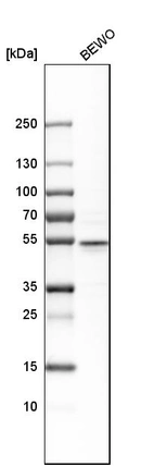 Western blot analysis in human cell line BEWO.