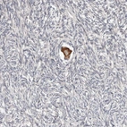 Anti-SMYD4 Antibody