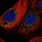 Immunofluorescent staining of human cell line A-431 shows localization to nucleoplasm, the Golgi apparatus & vesicles.