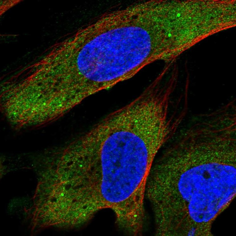 Anti-YTHDF2 Antibody
