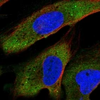 Anti-YTHDF2 Antibody