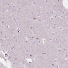 Anti-NOS1AP Antibody
