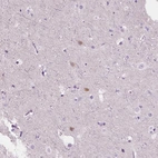Anti-NOS1AP Antibody