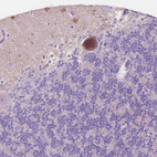 Immunohistochemical staining of human Cerebellum shows weak cytoplasmic positivity in Purkinje cells.