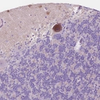Immunohistochemical staining of human Cerebellum shows weak cytoplasmic positivity in Purkinje cells.