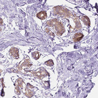 Immunohistochemical staining of human Breast shows moderate cytoplasmic positivity in glandular cells.