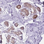 Immunohistochemical staining of human Breast shows moderate cytoplasmic positivity in glandular cells.