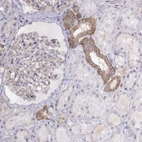 Immunohistochemical staining of human Kidney shows moderate cytoplasmic positivity in cells in distal tubules.