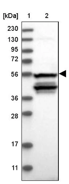 Lane 1: Marker [kDa] 230, 130, 95, 72, 56, 36, 28, 17, 11_br/_Lane 2: Human cell line RT-4