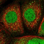 Immunofluorescent staining of human cell line A-431 shows localization to nucleus & vesicles.
