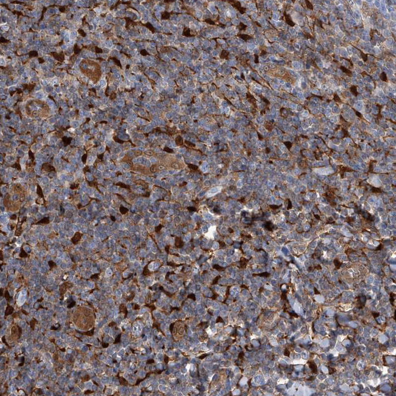 Anti-SERPINB9 Antibody