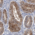 Immunohistochemical staining of human endometrium shows strong cytoplasmic positivity in glandular cells.