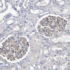 Immunohistochemical staining of human kidney shows weak cytoplasmic positivity in cells in glomeruli.