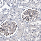 Immunohistochemical staining of human kidney shows weak cytoplasmic positivity in cells in glomeruli.