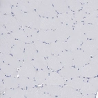 Immunohistochemical staining of human skeletal muscle shows no positivity in myocytes as expected.