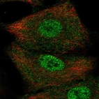 Immunofluorescent staining of human cell line A549 shows localization to nucleoplasm & cytosol.